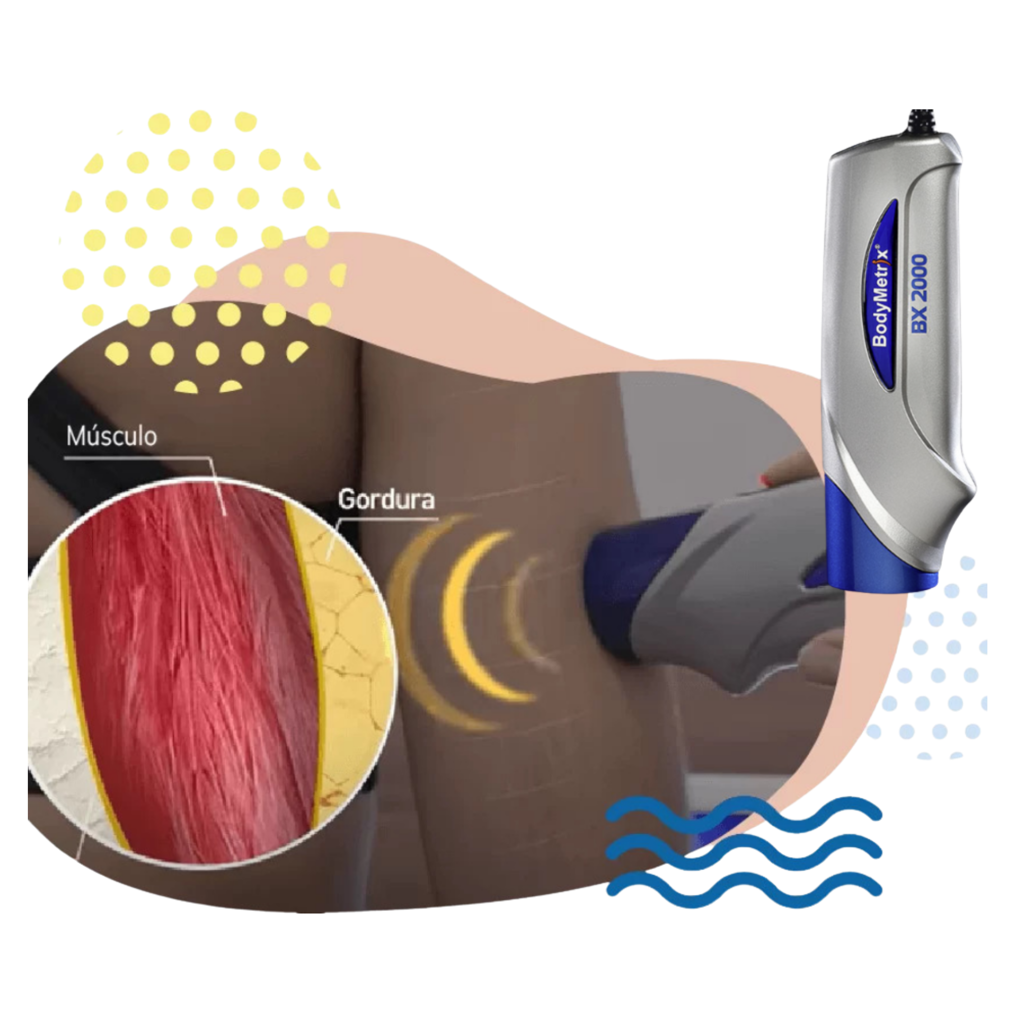 Ilustração da aplicação do transdutor BodyMetrix sobre a pele e das camadas de gordura e músculo